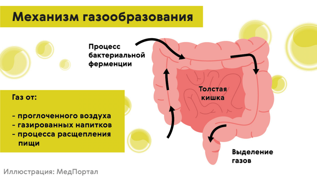 Вздутие живота - причины и лечение, к какому врачу обратиться